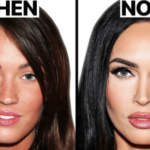 Megan Fox - Before and After Plastic Surgery