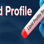 lipid profile test