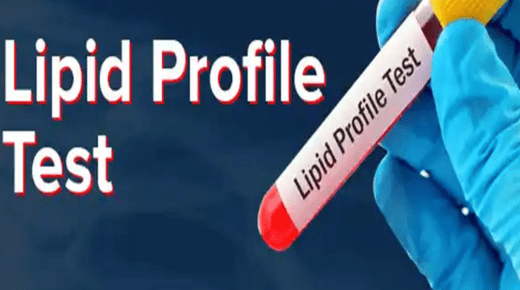 lipid profile test