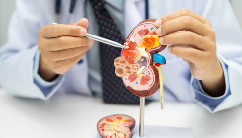 Best Nephrologist in bangalore